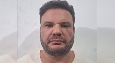 1 de 1 Rosto de homem - Metrópoles - Foto: Material cedido ao Metrópoles